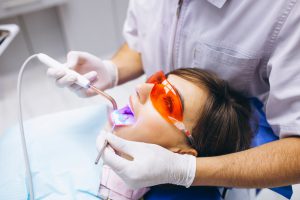 odontologia estética en burjassot - blanqueamiento dental